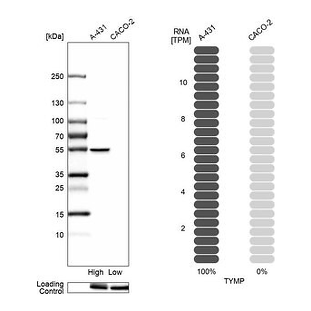 Merck Anti-TYMP antibody produced in rabbit