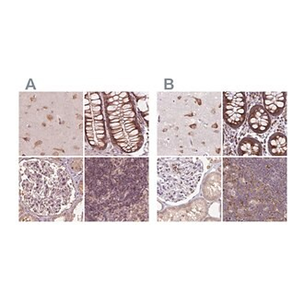 Merck Anti-RPS5 antibody produced in rabbit