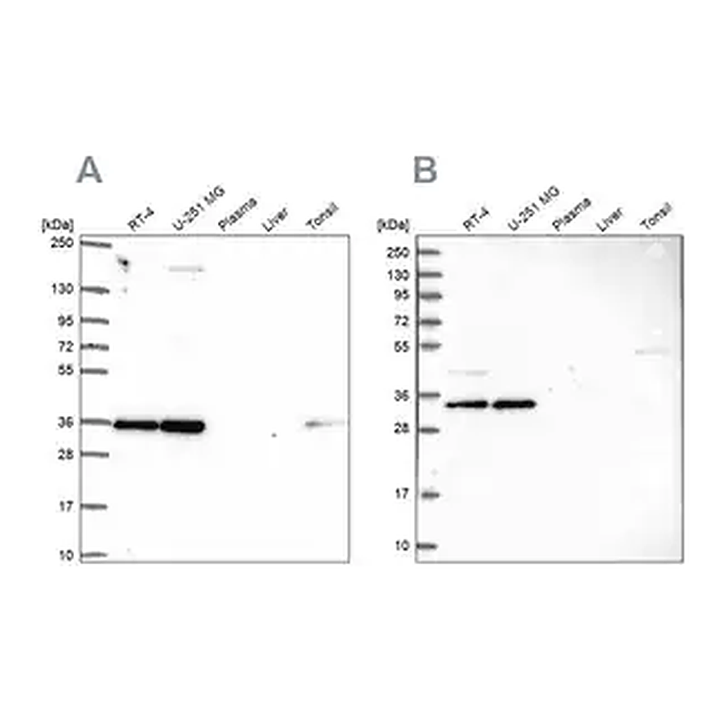 Merck Anti-NOSIP antibody produced in rabbit