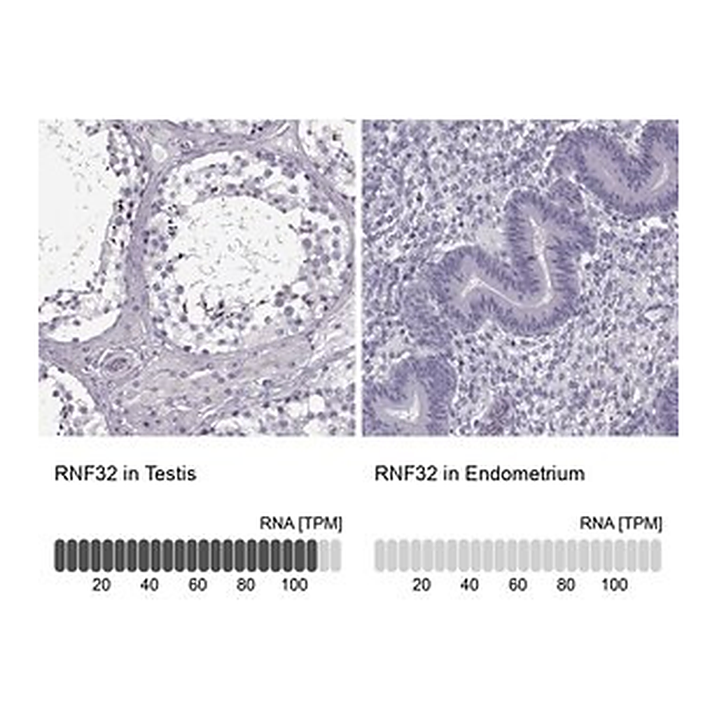 Merck Anti-RNF32 antibody produced in rabbit