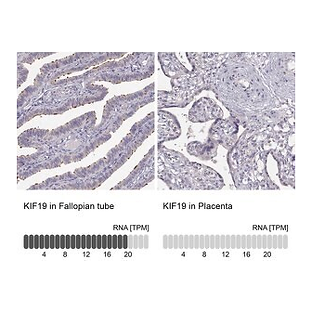 Merck Anti-KIF19 antibody produced in rabbit