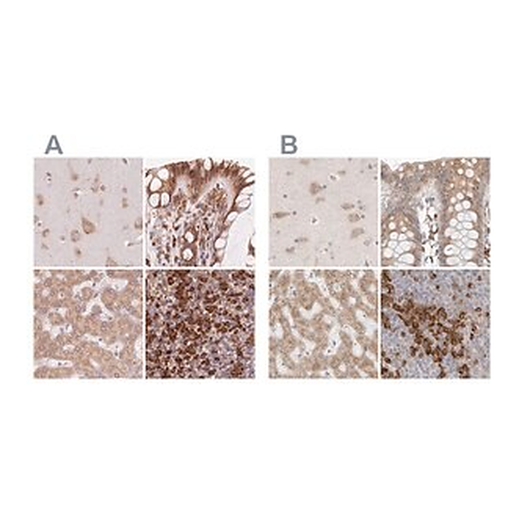 Merck Anti-RPN1 antibody produced in rabbit