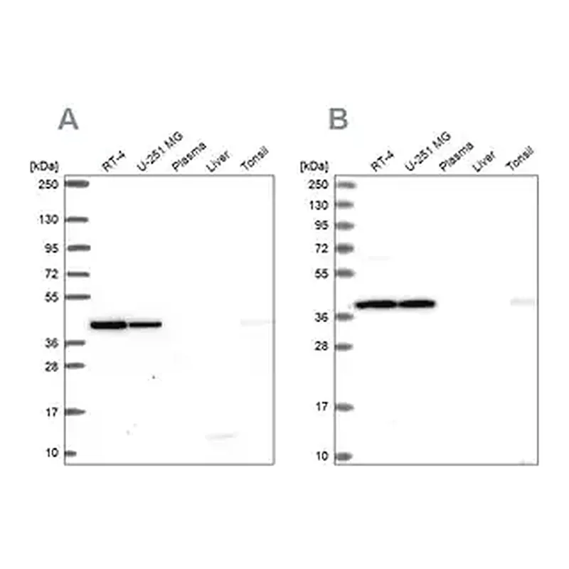 Merck Anti-IDH3A antibody produced in rabbit