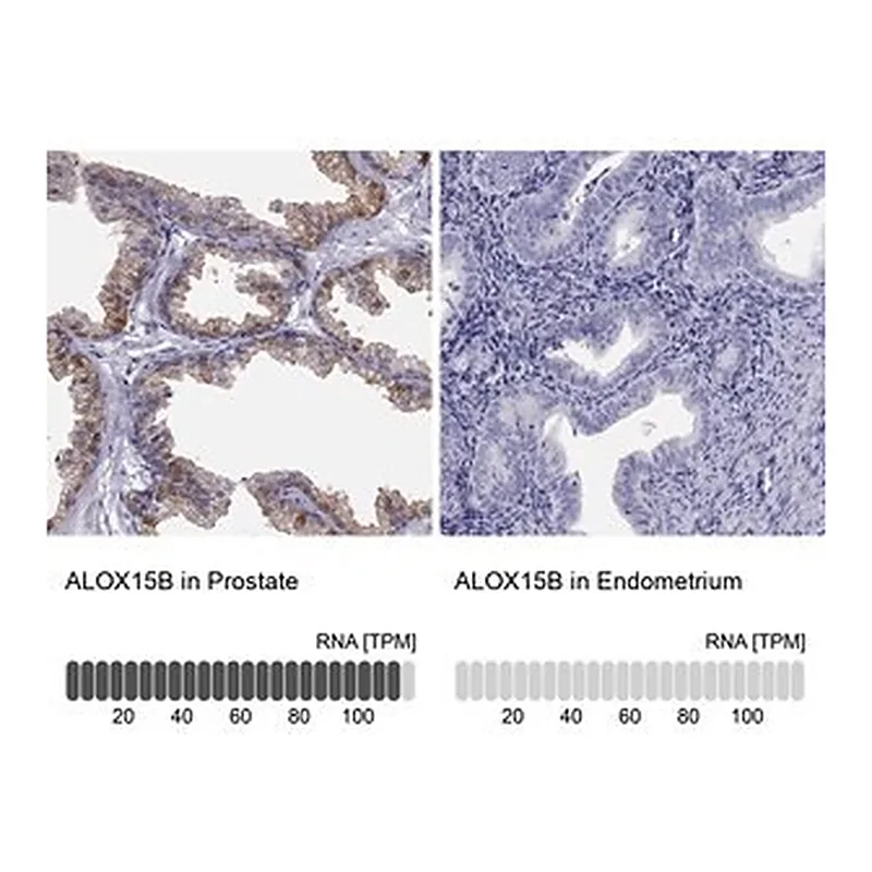 Merck Anti-ALOX15B antibody produced in rabbit