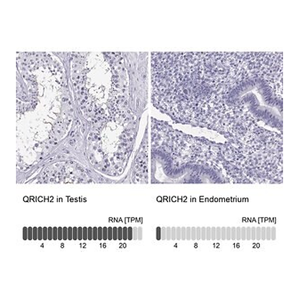 Merck Anti-QRICH2 antibody produced in rabbit