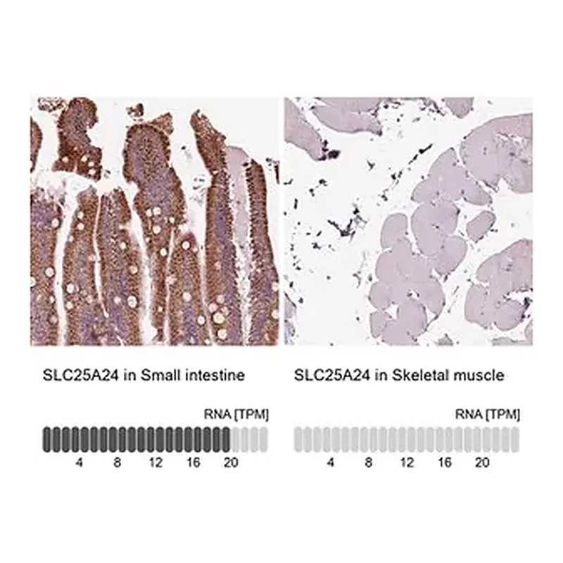 Merck Anti-SLC25A24 antibody produced in rabbit