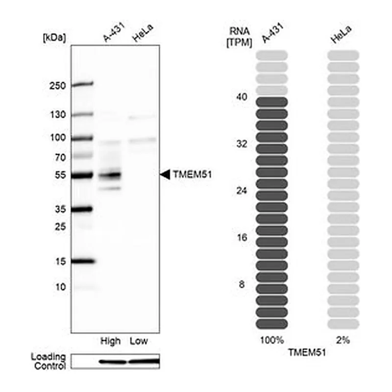 Merck Anti-TMEM51 antibody produced in rabbit