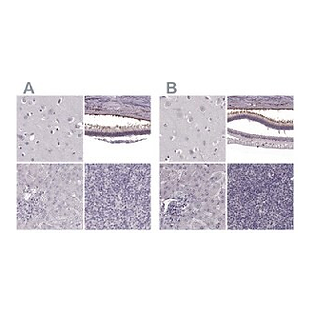 Merck Anti-RP1L1 antibody produced in rabbit