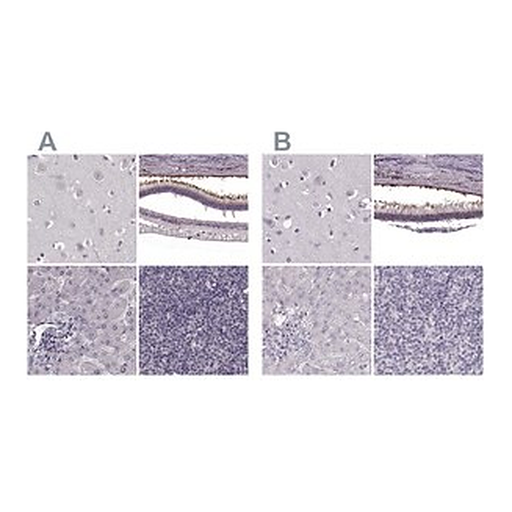 Merck Anti-RP1L1 antibody produced in rabbit