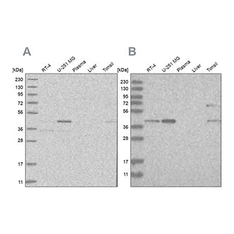 Merck Anti-RTCA antibody produced in rabbit