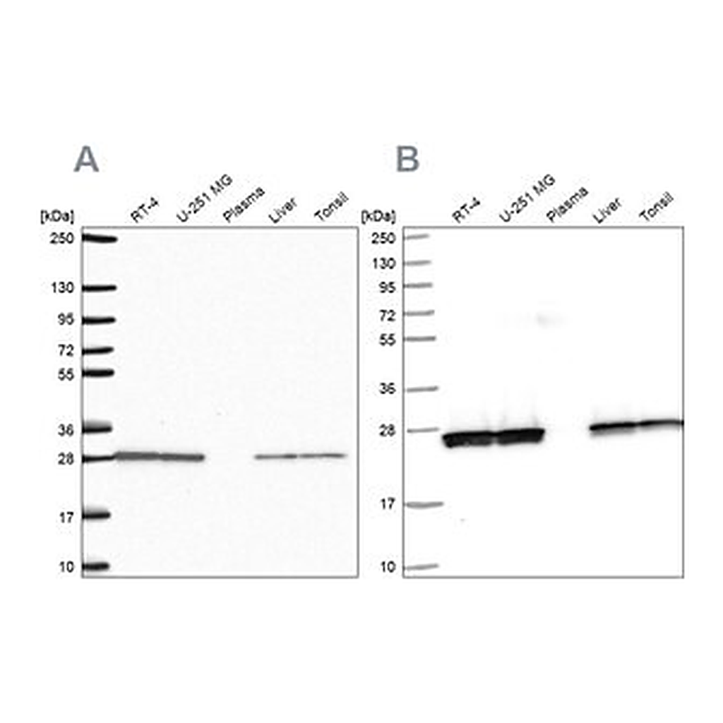 Merck Anti-TPI1 antibody produced in rabbit