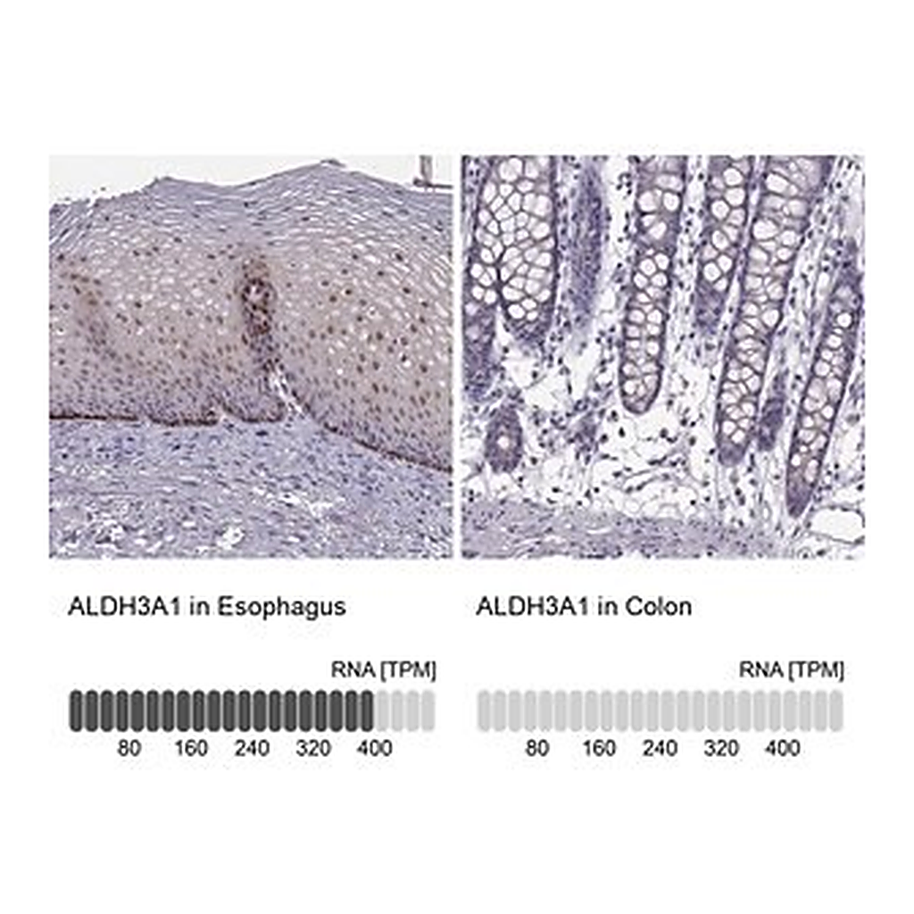 Merck Anti-ALDH3A1 antibody produced in rabbit