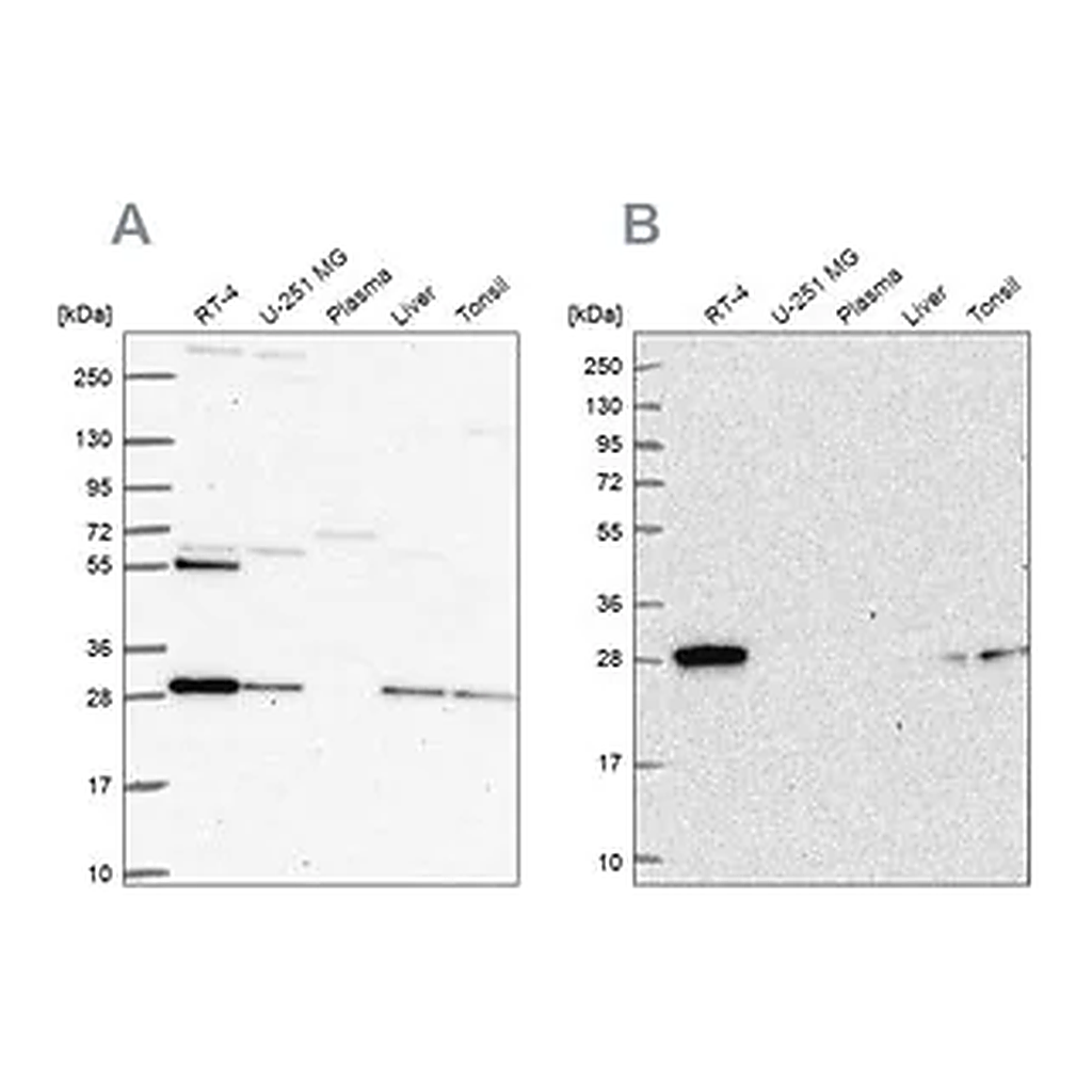 Merck Anti-PMM2 antibody produced in rabbit