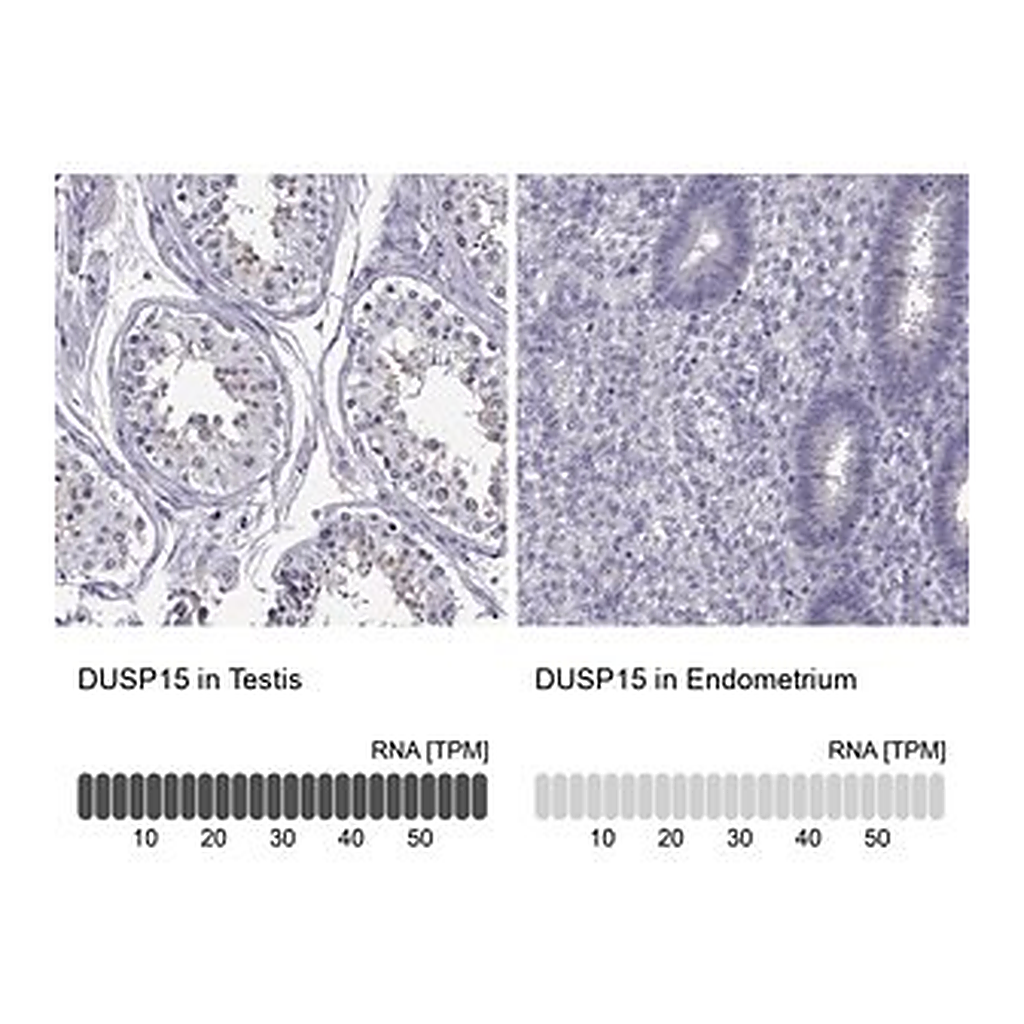 Merck Anti-DUSP15 antibody produced in rabbit