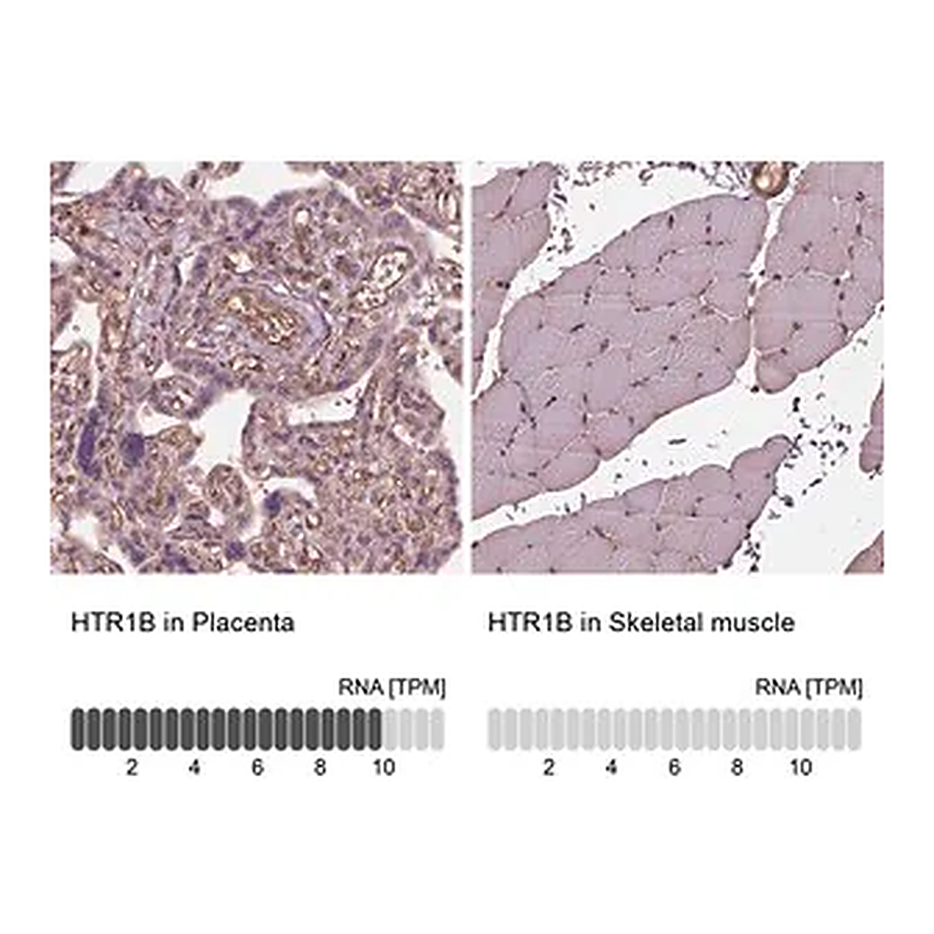 Merck Anti-HTR1B antibody produced in rabbit