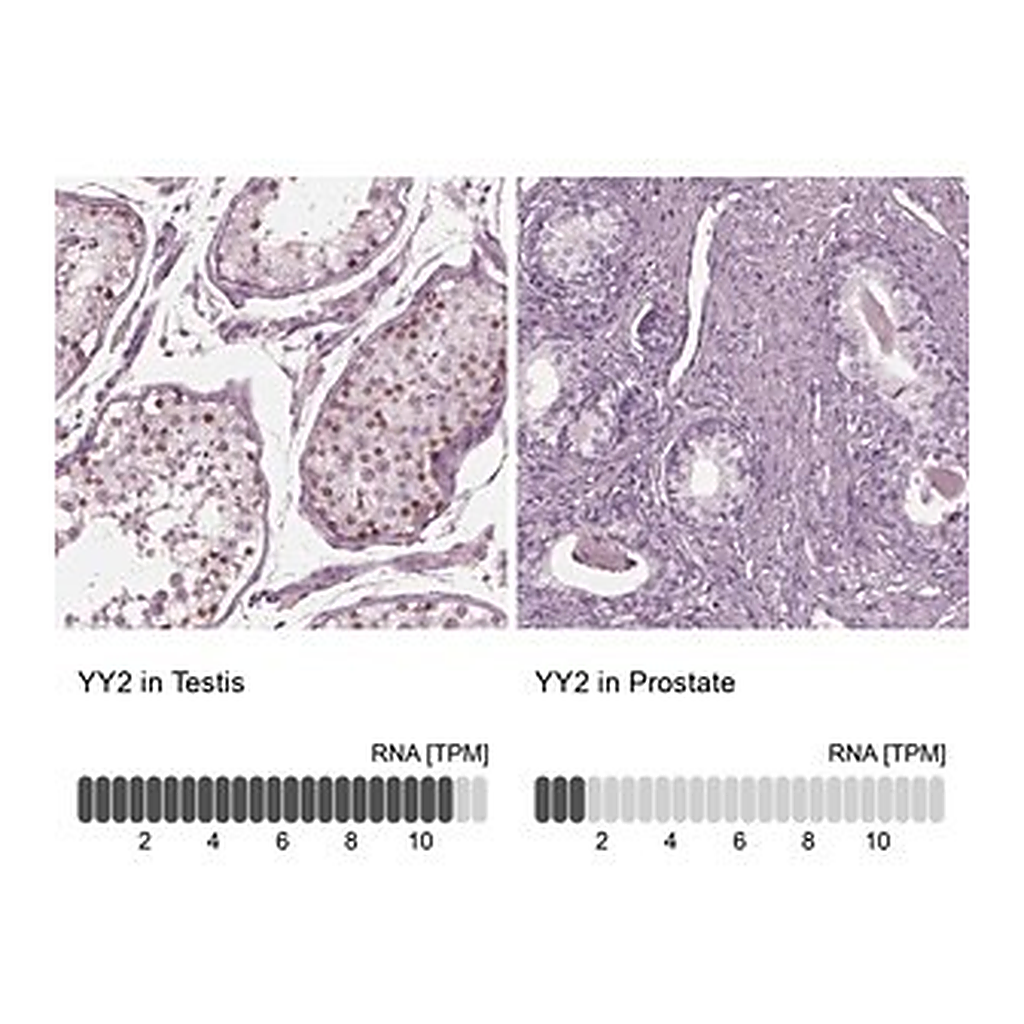 Merck Anti-YY2 antibody produced in rabbit