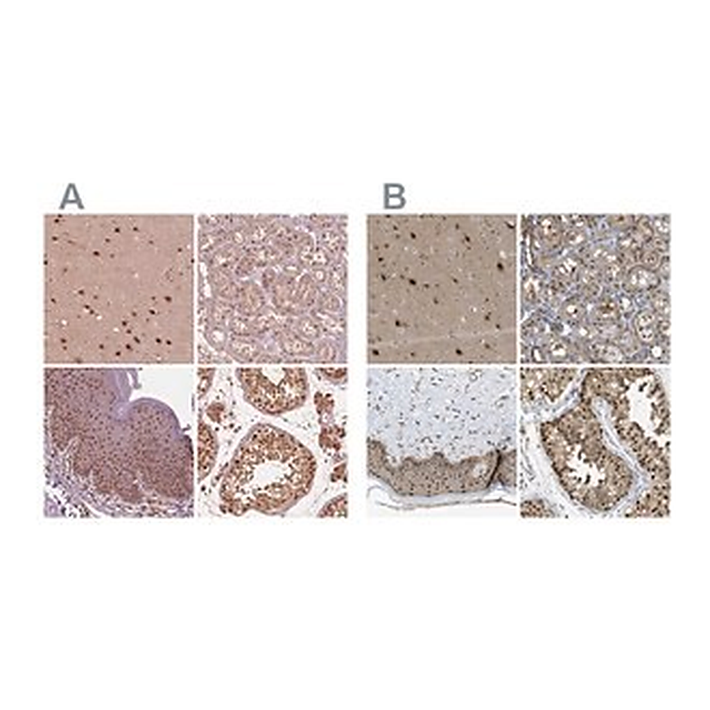 Merck Anti-PSMC5 antibody produced in rabbit