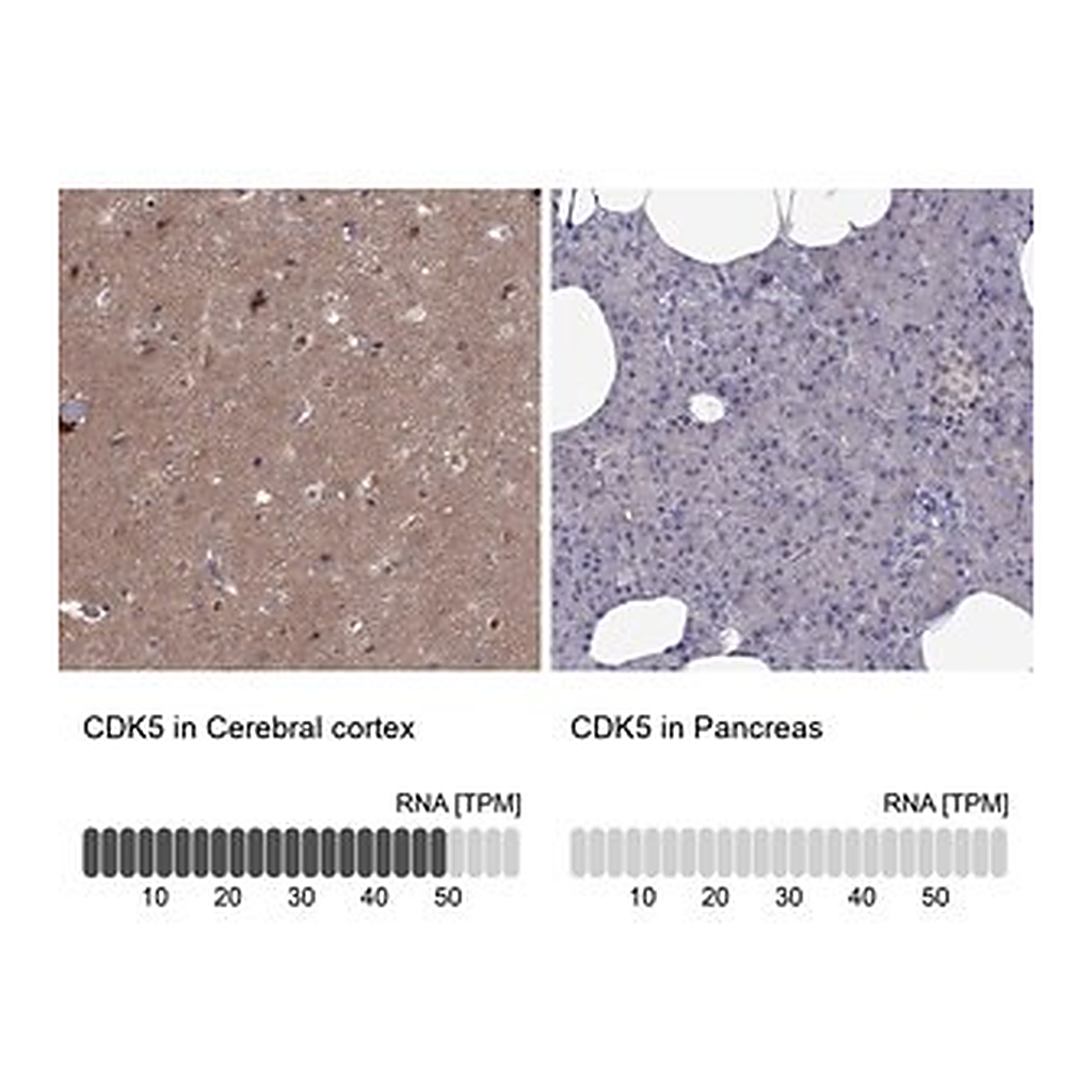 Merck Anti-CDK5 antibody produced in rabbit