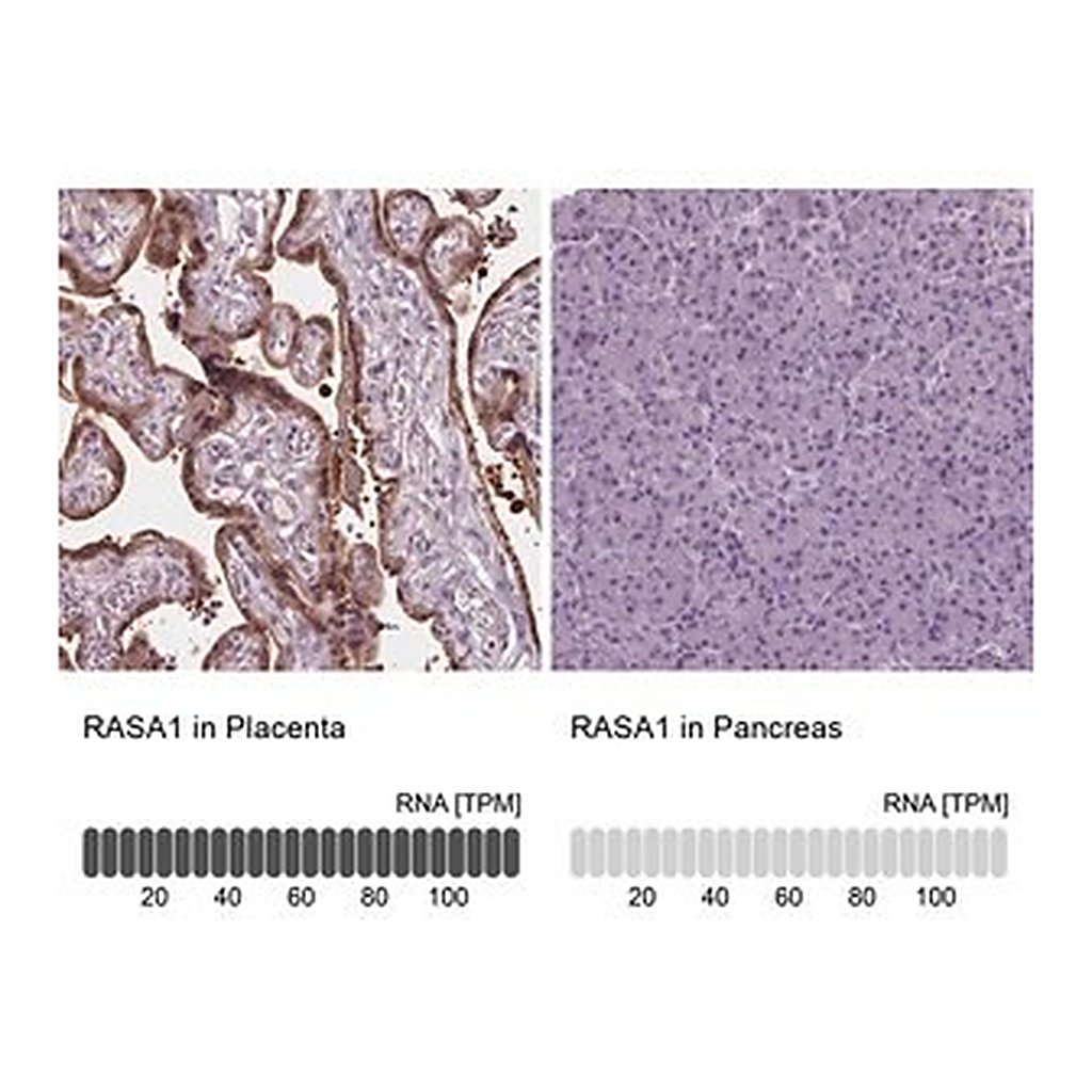 Merck Anti-RASA1 antibody produced in rabbit