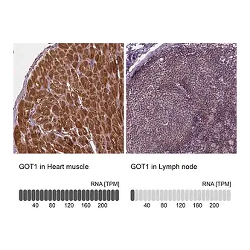 Merck Anti-GOT1 antibody produced in rabbit