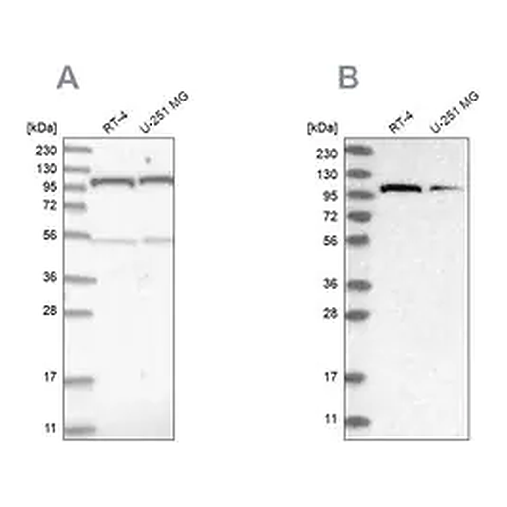 Merck Anti-OGT antibody produced in rabbit
