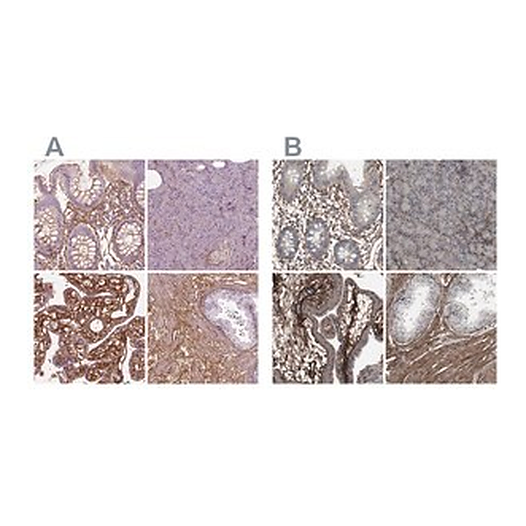 Merck Anti-COL6A2 antibody produced in rabbit