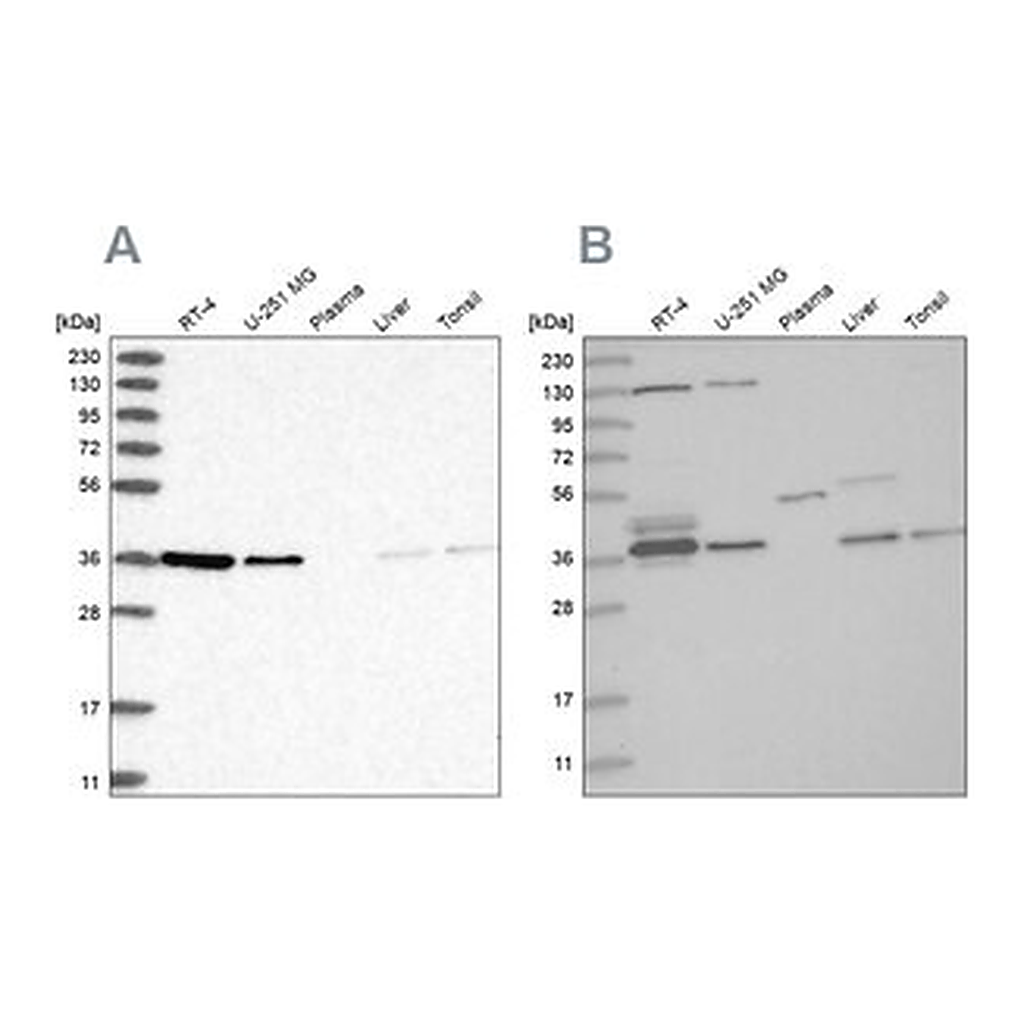 Merck Anti-VTA1 antibody produced in rabbit
