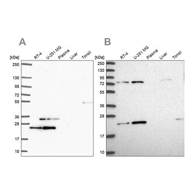 Merck Anti-EIF3K antibody produced in rabbit