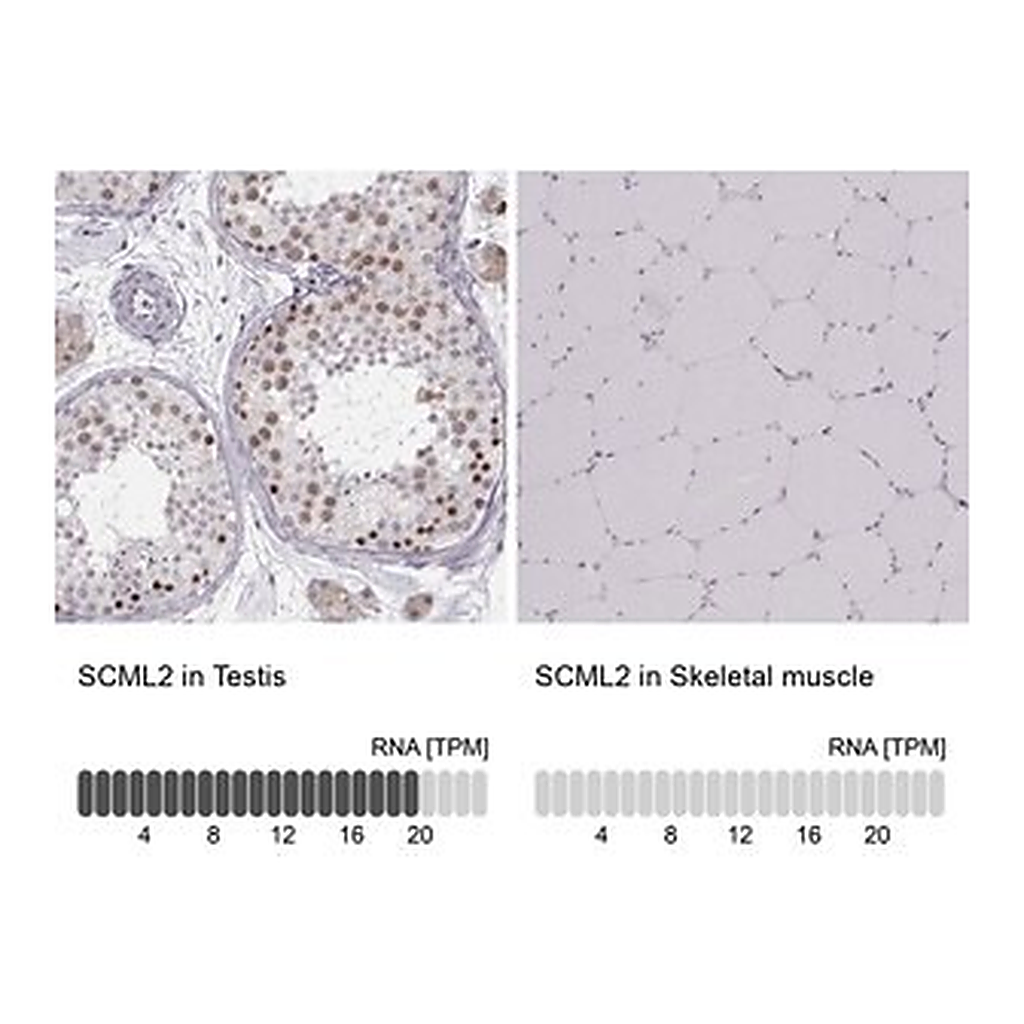 Merck Anti-SCML2 antibody produced in rabbit