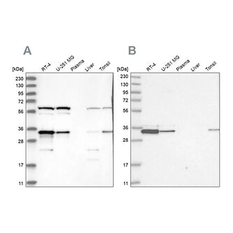 Merck Anti-PRKRA antibody produced in rabbit