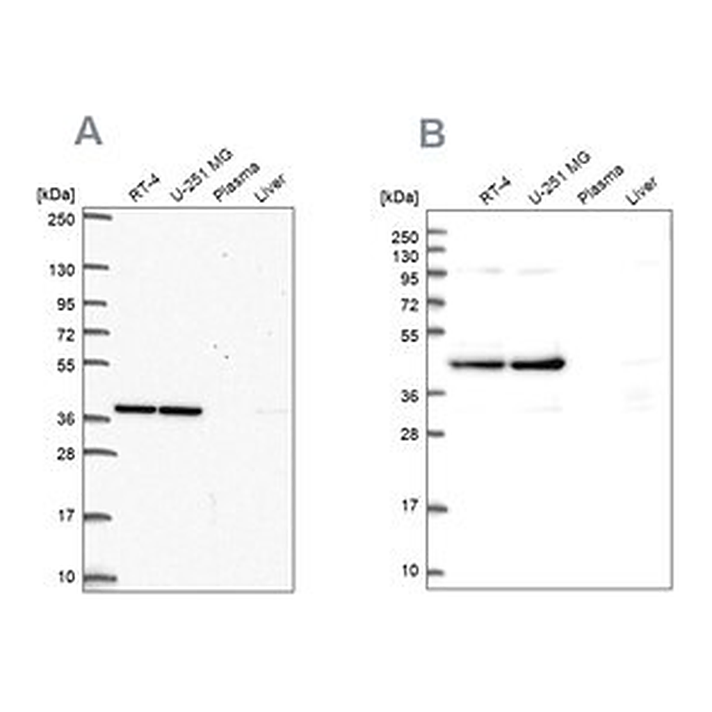 Merck Anti-CCDC94 antibody produced in rabbit