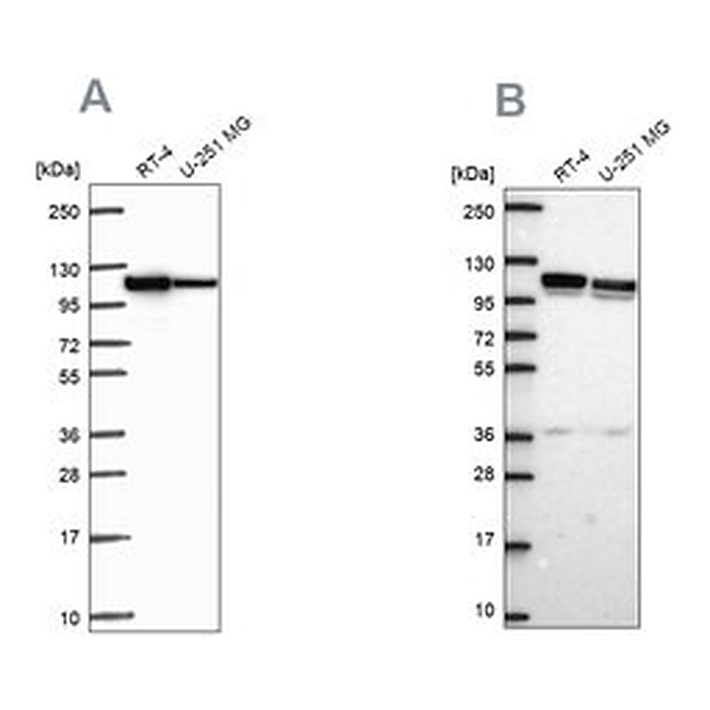 Merck Anti-AP1B1 antibody produced in rabbit