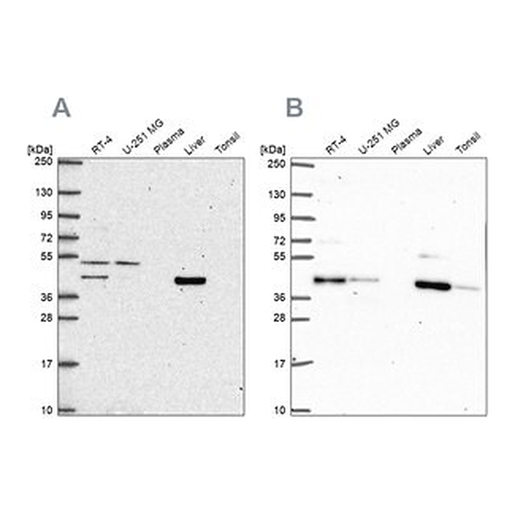 Merck Anti-PHKG2 antibody produced in rabbit
