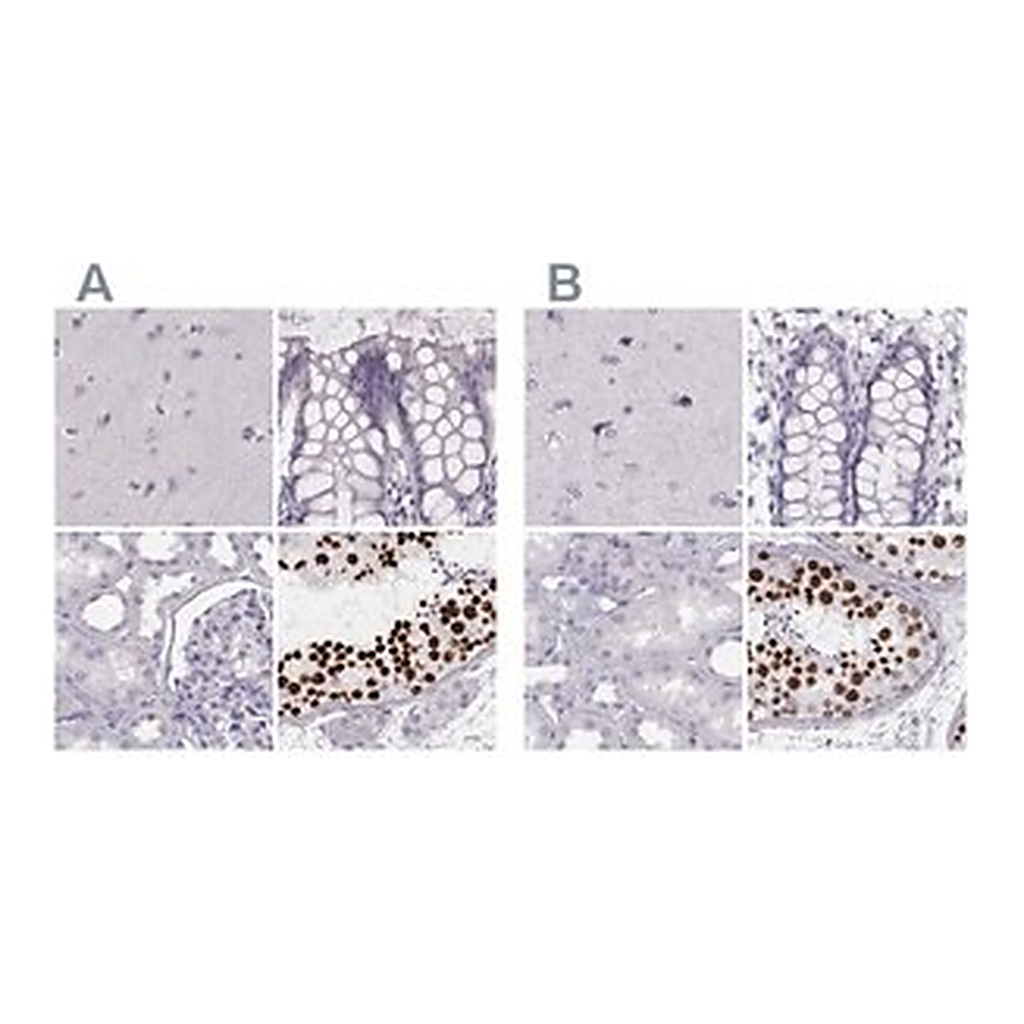 Merck Anti-HIST1H1T antibody produced in rabbit