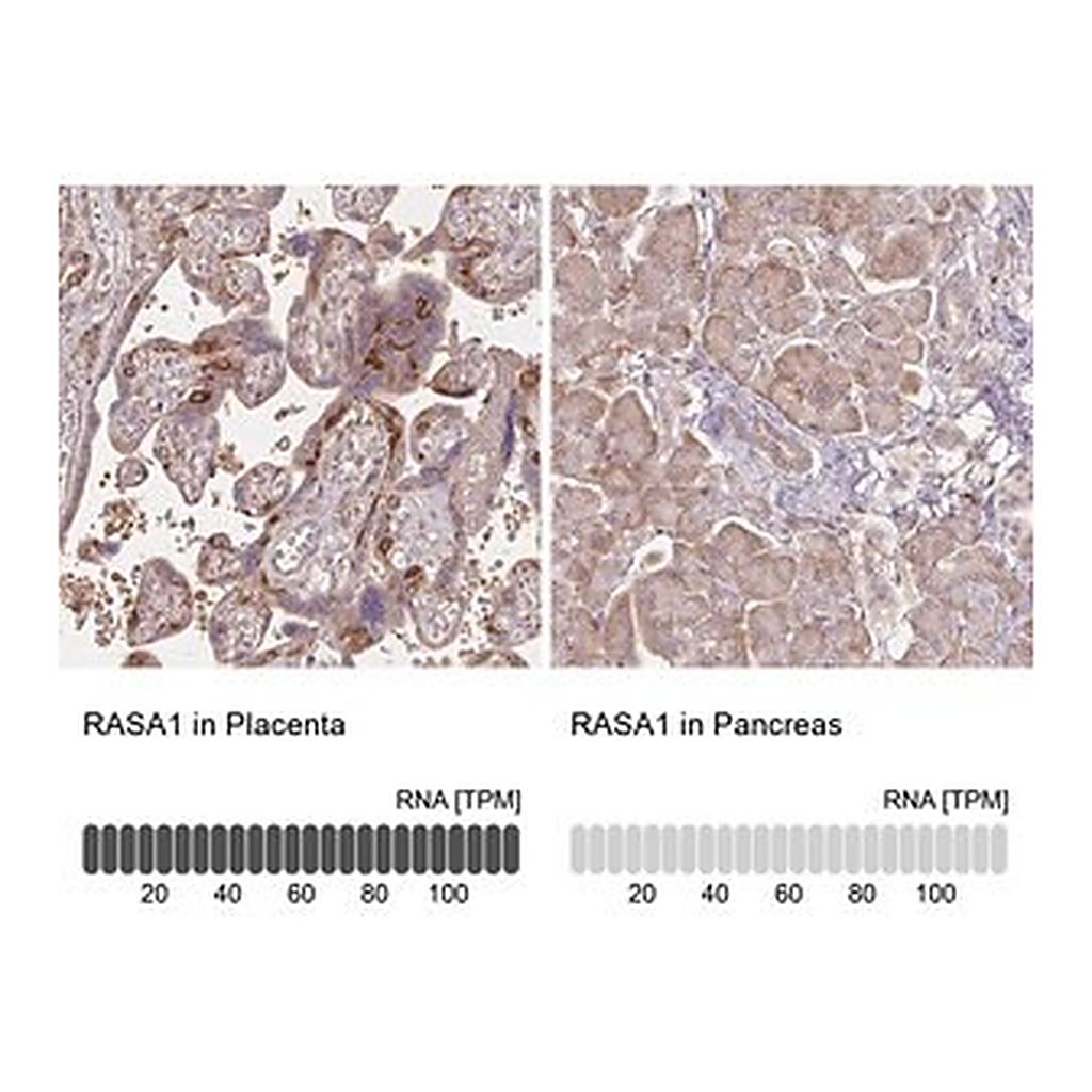 Merck Anti-RASA1 antibody produced in rabbit