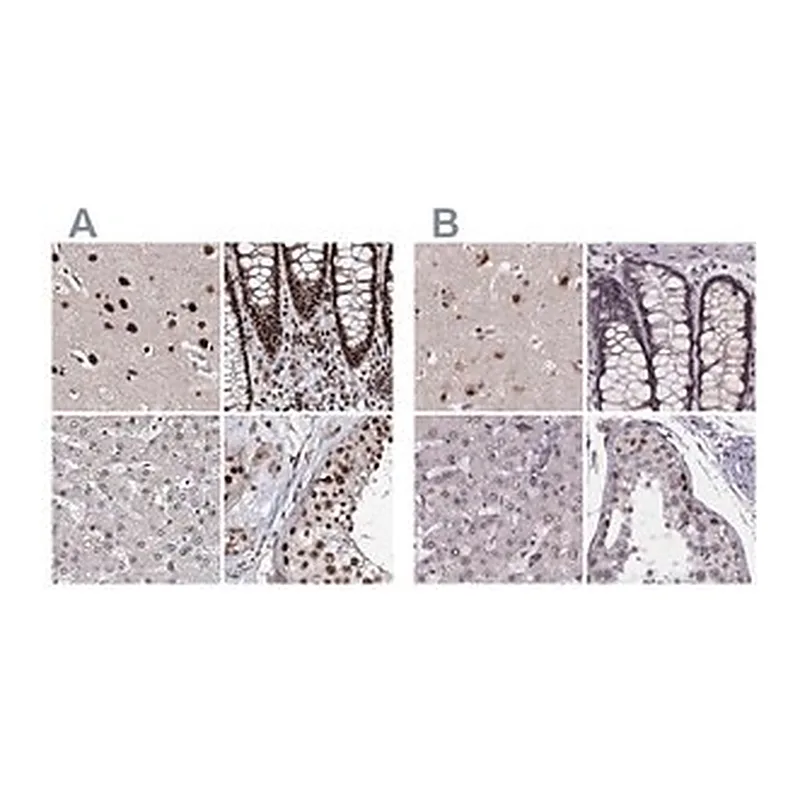 Merck Anti-U2SURP antibody produced in rabbit