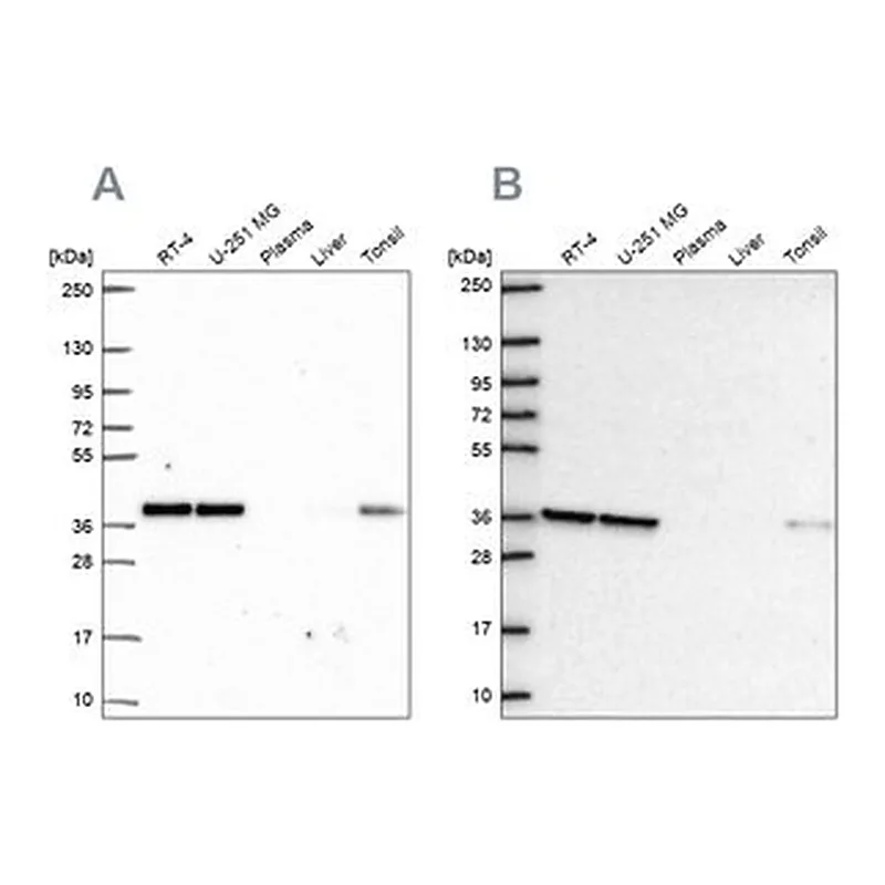 Merck Anti-NUP37 antibody produced in rabbit