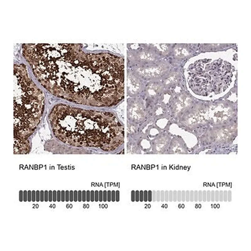 Merck Anti-RANBP1 antibody produced in rabbit