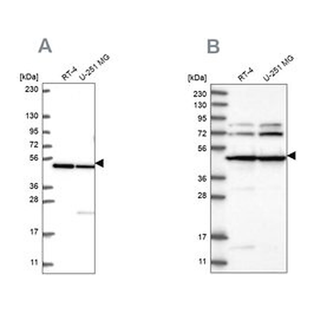 Merck Anti-HADHB antibody produced in rabbit