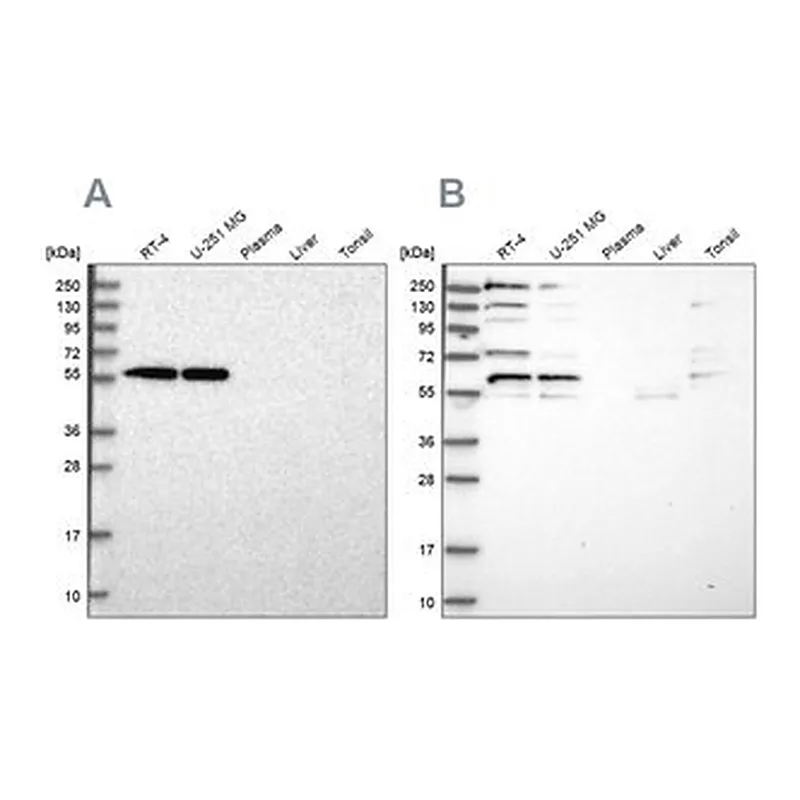 Merck Anti-SAAL1 antibody produced in rabbit