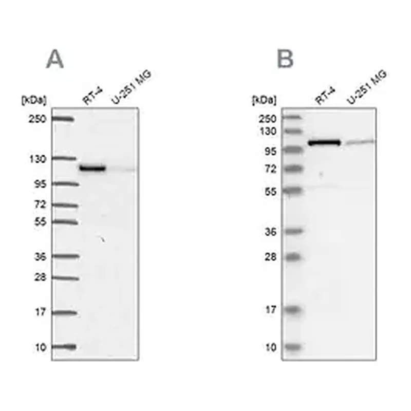 Merck Anti-PRKD2 antibody produced in rabbit