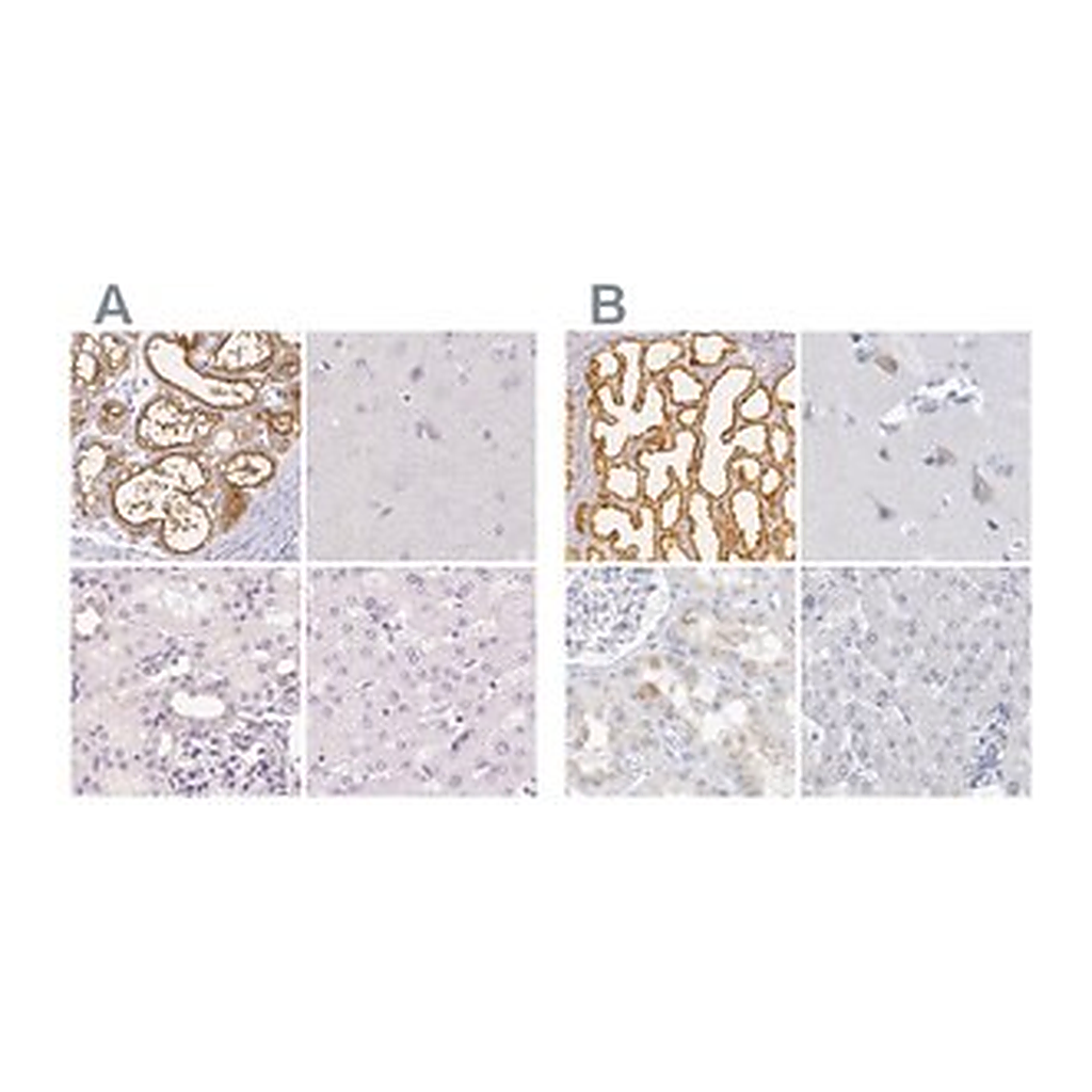 Merck Anti-CSN1S1 antibody produced in rabbit | 캐시바이