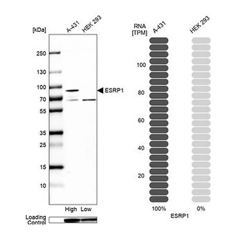 Merck Anti-ESRP1 antibody produced in rabbit