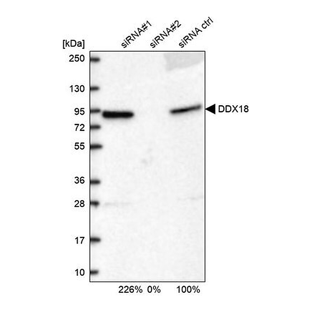 Merck Anti-DDX18 antibody produced in rabbit