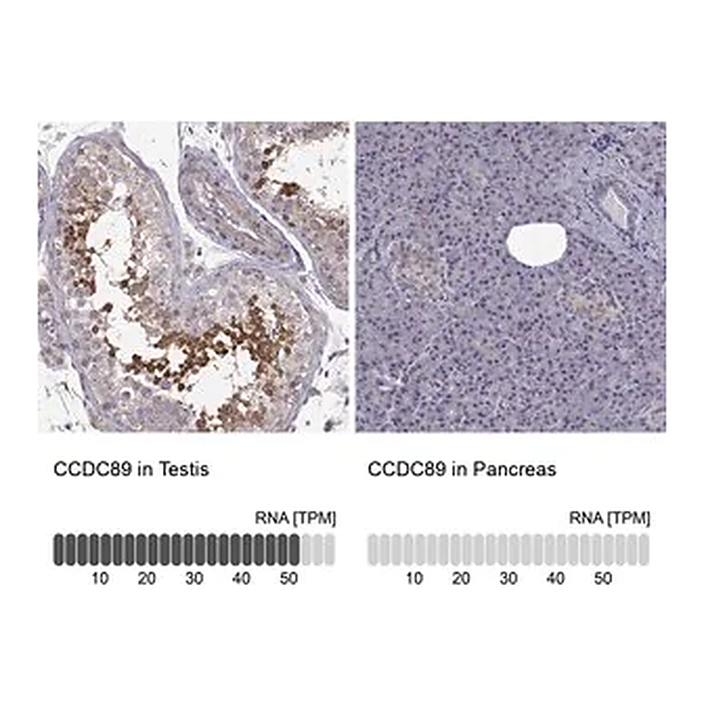 Merck Anti-CCDC89 antibody produced in rabbit