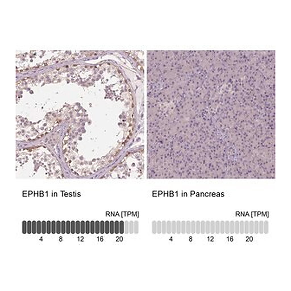 Merck Anti-EPHB1 antibody produced in rabbit