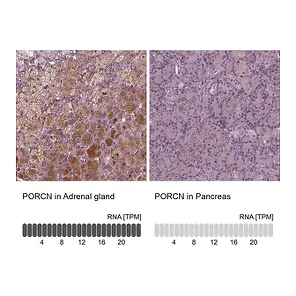 Merck Anti-PORCN antibody produced in rabbit