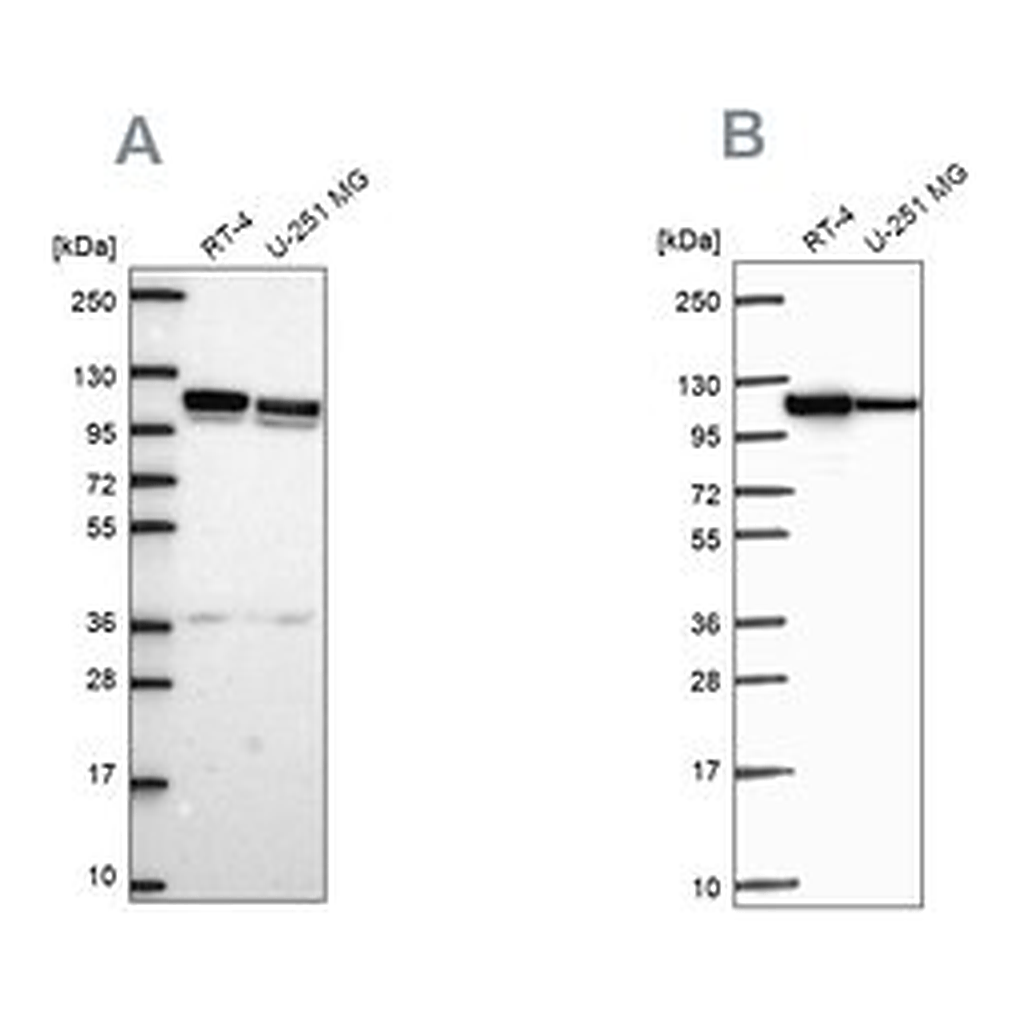 Merck Anti-AP1B1 antibody produced in rabbit