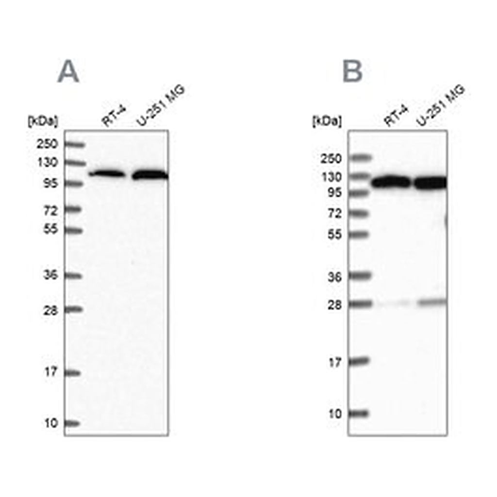 Merck Anti-AARS antibody produced in rabbit
