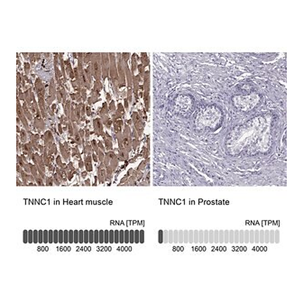 Merck Anti-TNNC1 antibody produced in rabbit